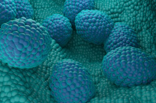 New Surgery for Prostate Cancer Could Reduce Some Unwanted Side Effects