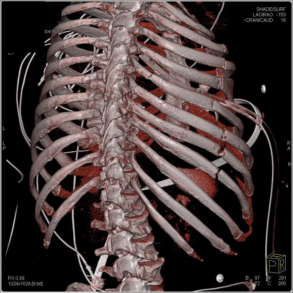 Wounds and injuries cover image