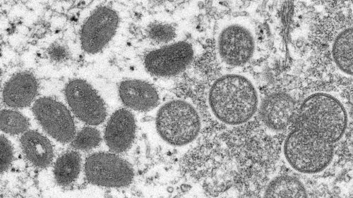 Canada shipping vaccines to Quebec as province confirms 15 monkeypox cases