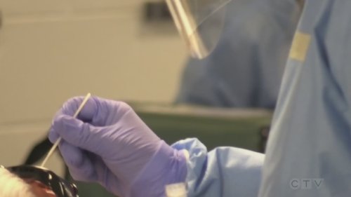 491 new COVID-19 cases in Manitoba Friday