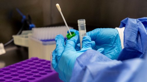 City of Saskatoon launching mandatory COVID-19 testing program for staff