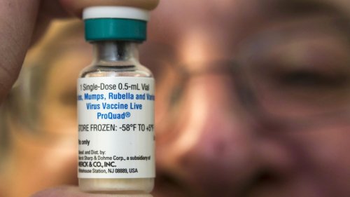 1st case of measles reported in B.C. over the weekend: Health Ministry