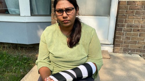 International student recovering from injuries after dog bite in northeast Calgary neighbourhood