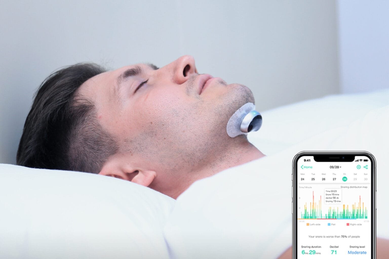 Stop snoring to death with this innovative wearable Canada Today