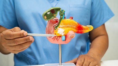 Cancer foudroyant du pancréas : deux thérapies porteuses d’espoir - Curieux!