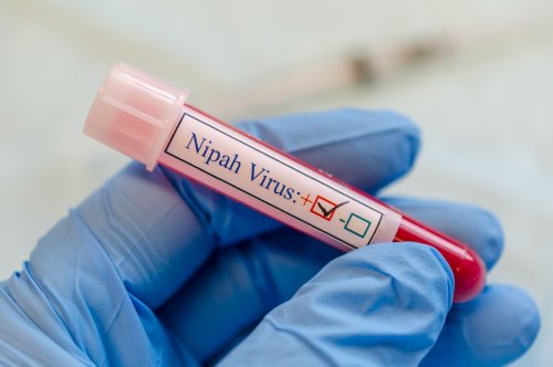 Virus Nipah : vers une nouvelle pandémie mortelle ? - Curieux!