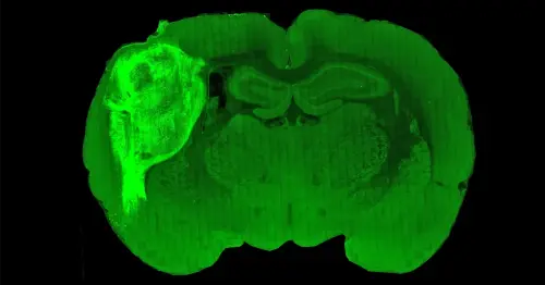 Lab-Grown Human Cells Form Working Circuits in Rat Brains