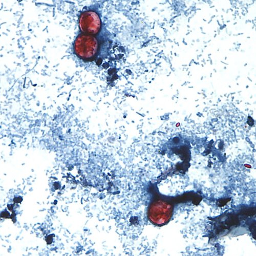 What we know about the cyclosporiasis outbreak linked to produce