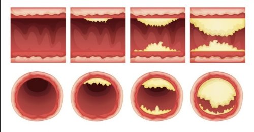 20 Foods That Will Clean Your Arteries Naturally And Protect You From Heart Attacks