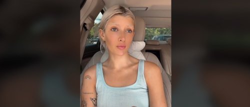Sami Sheen Says Boob Job Is ‘Honestly Going To Save My Life’