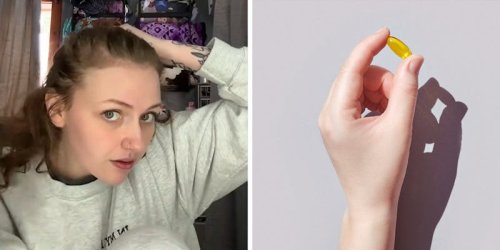 ‘I literally was going bald’: Woman notices hair regrowth. Then she shares the one product she used to see results