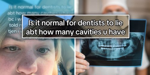 Dentist Allegedly Lied About Woman Having 15 Cavities—She Asked A Second Dentist