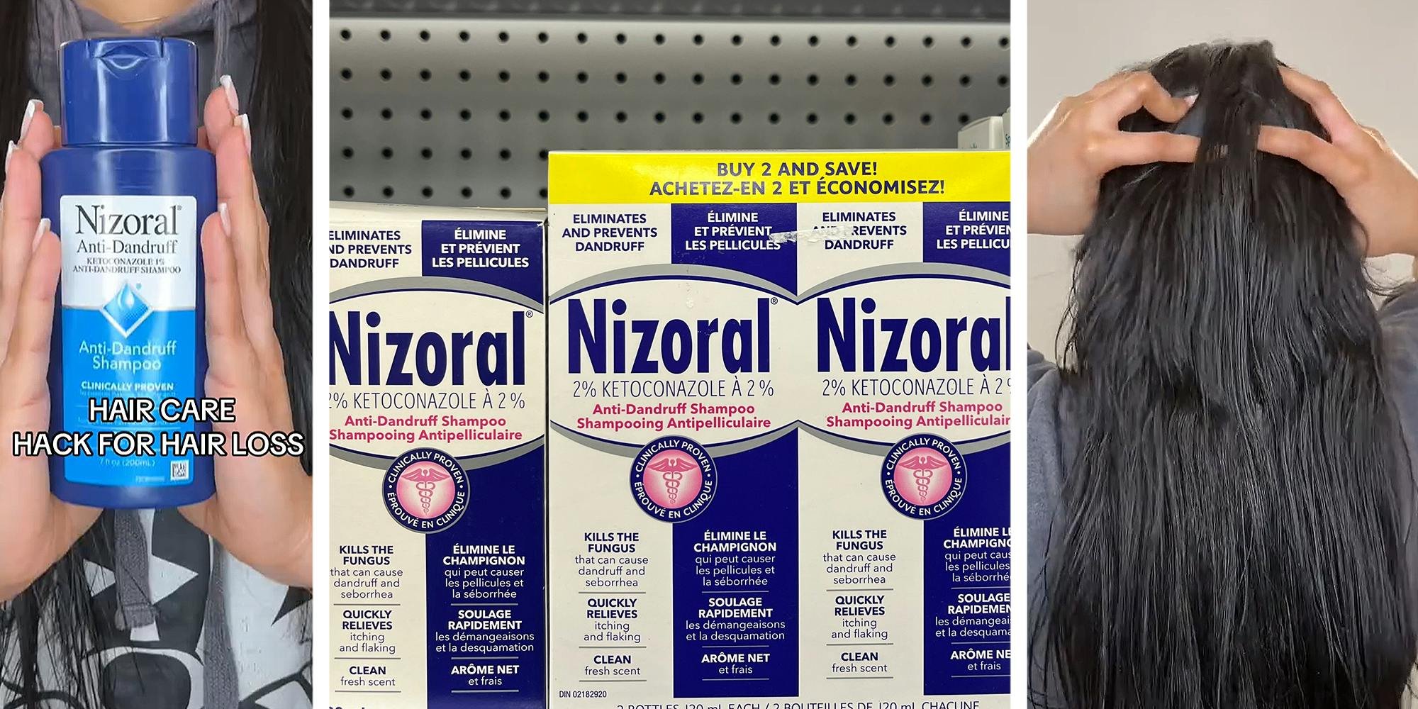 ‘My hair is growing fast’: Expert lathers Nizoral shampoo. Then she shows how to use it to combat hair loss
