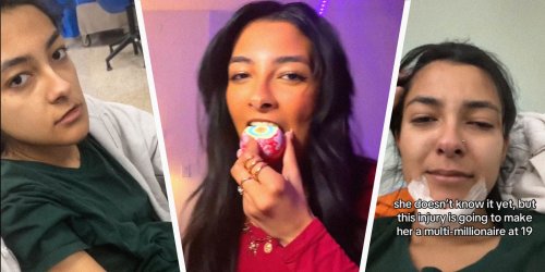 Woman Bites Into A Jawbreaker Candy. Then She Has To Go To The Hospital