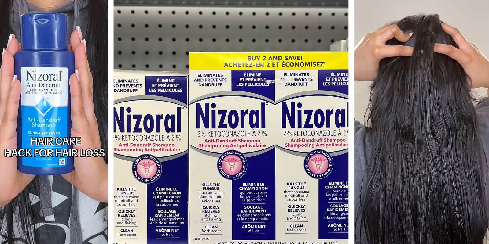 Expert Lathers Nizoral Shampoo, Shows How To Use It To Combat Hair Loss