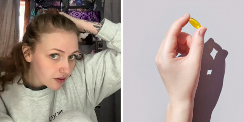 ‘I Literally Was Going Bald’: Woman Shares 1 Product That Caused Hair Regrowth