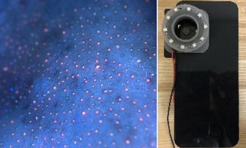 Smartphone can be used to detect dental plaque with new device