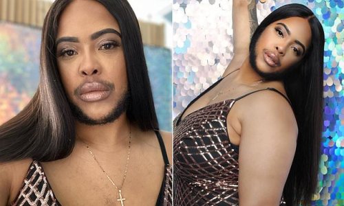 Woman Who Suffers From Hormonal Disorder Which Makes Her Grow Facial Hair Decides To Embrace Her