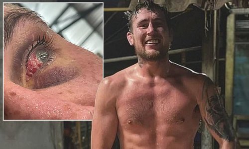 'I felt the guy's middle finger go to the back of my brain': Darren Till reveals details of injury from horrific eye poke in training camp - and admits he feared UFC 282 clash with Dricus du Plessis was at risk