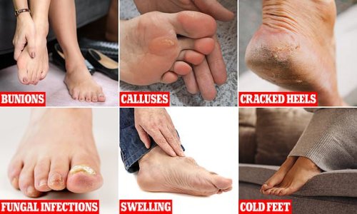 What do YOUR feet say about your health?