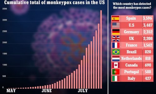 America will have biggest monkeypox outbreak in world within days: Cases in the U.S. surge to nearly 3,500