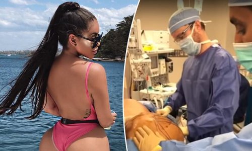 Influencer Zilla 'Miss Zedd' Stacey reveals reality of her $15,000 Brazilian butt lift