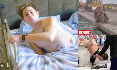 'It's been a long and wild journey': Teen who had half of his body amputated after being crushed by a forklift truck marks three-year anniversary since horror accident by sharing emotional video with his wife