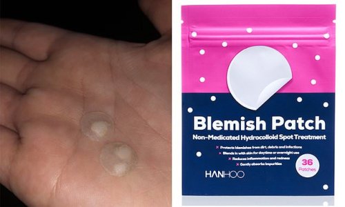 Woman praises $2 blemish patches cleared up her acne 'cysts' in just four hours