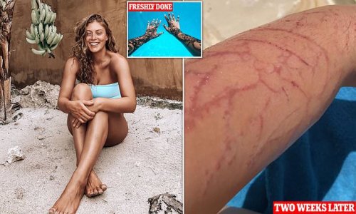 Woman, 23, who suffered a 'burning' allergic reaction to henna tattoos she had inked while on holiday in Zanzibar says she is still 'scarred' four months later