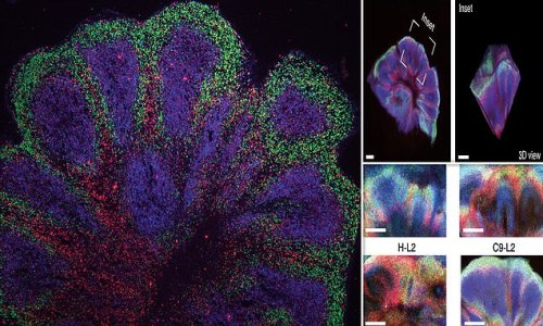 Lab-grown 'mini brains' developed from motor neurone patients