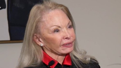 Distraught women show what plastic surgeon did to their faces after they asked to be 'refreshed'
