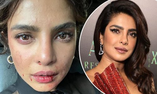 'Did you have a tough day at work as well?' Priyanka Chopra shows off bruised and battered makeup as she films spy series Citadel