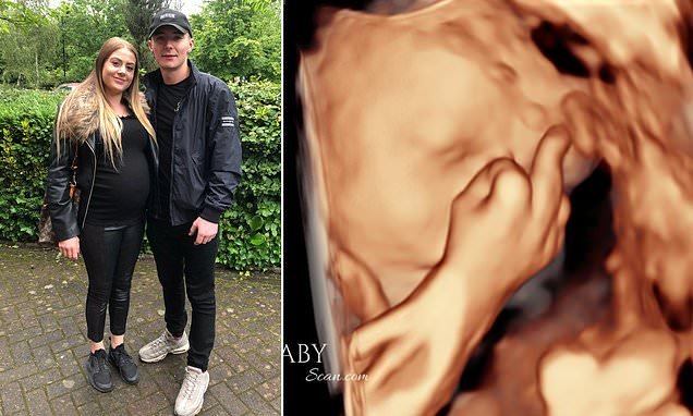 Unborn baby boy stuns first-time parents when a 4D scan shows him giving them the MIDDLE FINGER - and his mother's now convinced her son will be a 'handful'