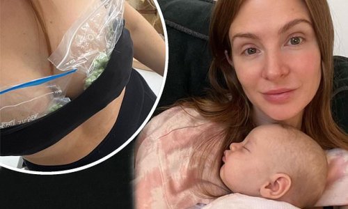 Millie Mackintosh reveals she is using FROZEN PEAS on her nipples