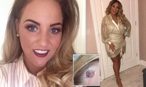 Tanning addict, 29, discovers she has cancer on the way to a sunbed