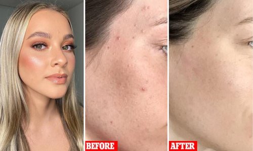 The only two products you need for glowing 'angel' skin