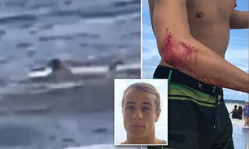 Surfer, 23, bitten by a shark off the coast of Florida goes to a BAR instead of the hospital