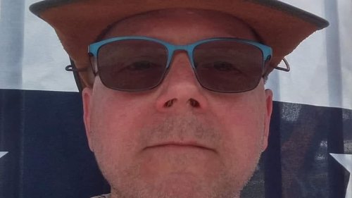 Trump supporter who was shot twice during ex-president's assassination attempt speaks out for the...