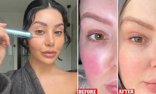 Aussie skincare brand launches eye cream that blurs lines & crows feet