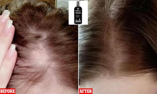 This £14 hair growth shampoo works so well Amazon shoppers are hailing it 'magical'