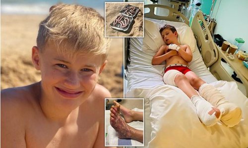 Parents call for beach ban on disposable BBQs: Pupil on school trip nearly severs his Achilles tendon on metal as boy is left needing skin grafts after stepping on 'red hot' sand