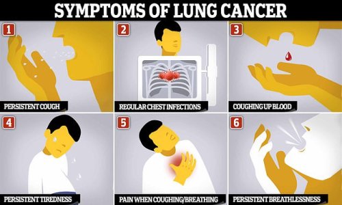 Lung cancer warning signs: As Dame Esther Rantzen, 82, reveals diagnosis, the tell-tale symptoms to be aware of - including a bizarre change which can happen to your fingers...