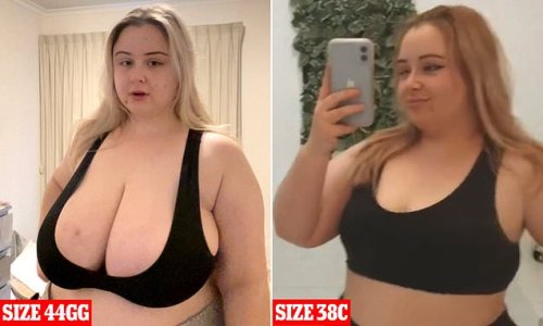 Carer whose 44GG breasts meant she was in constant pain and struggled with everyday tasks like cleaning says having 10lb of fat removed in a breast reduction surgery is the 'best thing she's ever done'