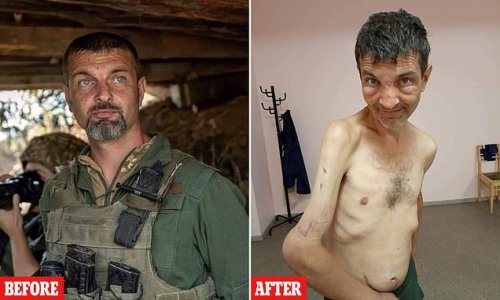 The price of captivity: Hero defender of Mariupol lays bare his horrific war wounds as he is reunited with his family after four months of being kept prisoner by Putin's men
