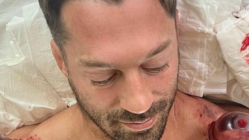 GRAPHIC WARNING: Olivia Newton-John's martial arts expert son-in-law is left blood-soaked as undergoes bizarre procedure