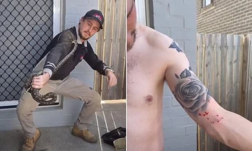 Snake catcher removes his shirt to show off the multiple bites he copped after trying to remove an aggressive carpet python