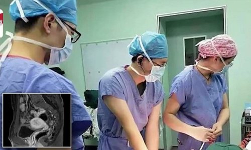 Chinese man, 33, who went to doctors with urinary problem is shocked to learn he was born with ovaries and a uterus - and has been menstruating for 20 years
