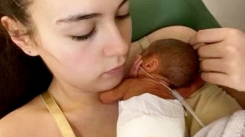 My twins were born 22 DAYS apart - only one survived: Agony of mother, 22, whose waters broke before...