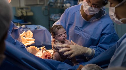 Brazilian baby who went viral seconds after she was born by frowning at doctor is now a 'smart,...