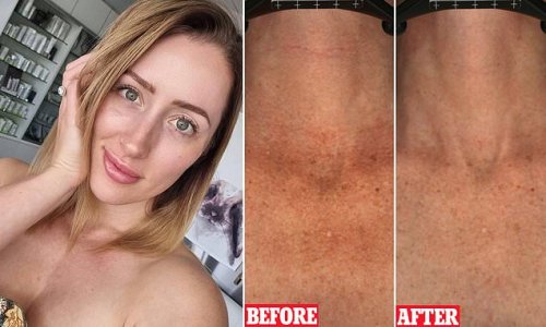 Why this BODY skincare is a must-have this winter